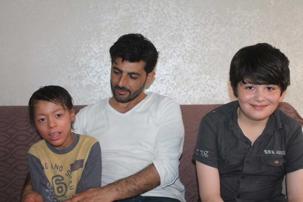 Lamellar İktiyozis Hastası 8 Yaşındaki Melih  iyileşmeye Başladı 11