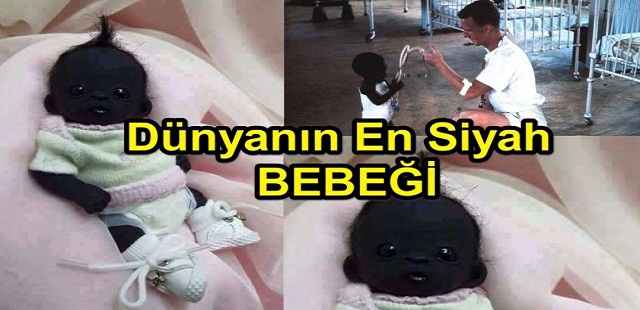 İnanmıcaksın Ama  Dünyanın En Sihay Bebeği 1