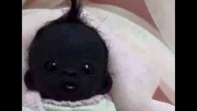 İnanmıcaksın Ama  Dünyanın En Sihay Bebeği 4