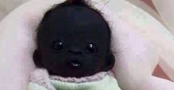 İnanmıcaksın Ama  Dünyanın En Sihay Bebeği 6