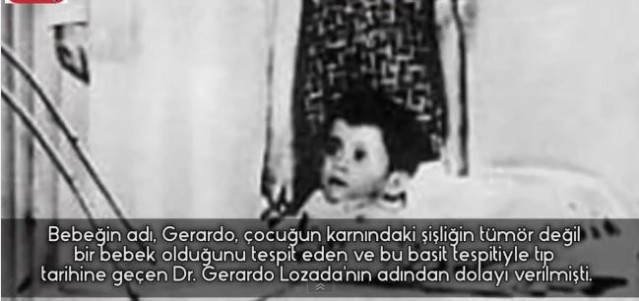 5 Yaşında Nasıl Anne Oldu ? Küçük Annenin Hikayesi Şaşkına Çevirdi 14