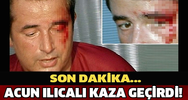 Acun Ilıcalı Kaza Geçirdi!!! Türkiye Şokta... 1