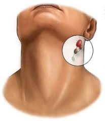 Boynunuzun burasına bir buz küpü koyun ve mucizeye şahit olun. İnanılmaz 10