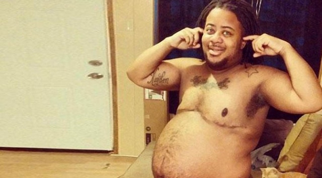 Sırtım Ağırıyor Dedi Hastaneye Gitti Hamile Olduğunu Öğrendi ! 2